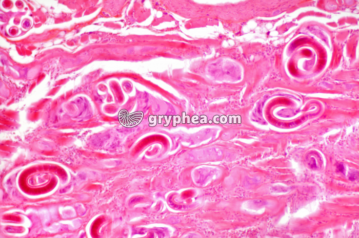 Trichines - vers parasites - Trichinella spiralis dans un muscle x40 - gryphea.org